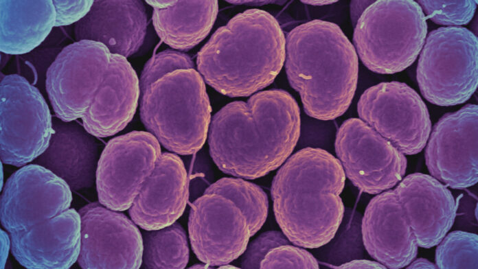 Trump administration guts CDC lab on sexually transmitted diseases