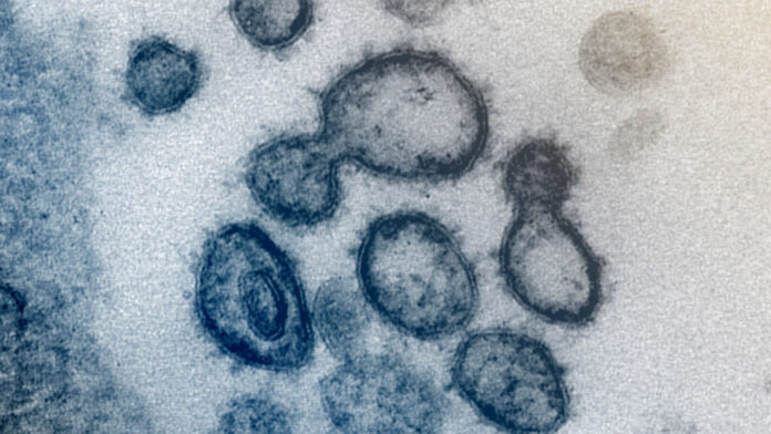 Wuhan lab leak theory replaces Covid facts on White House website